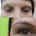 vignettes/esthetique/avant-apres.jpg